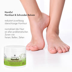 HornEx! Hornhaut und Schrunden Balsam mit 25% Urea