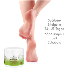 HornEx! Hornhaut und Schrunden Balsam mit 25% Urea
